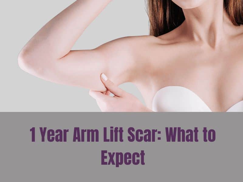 1 Year Arm Lift Scar What to Expect