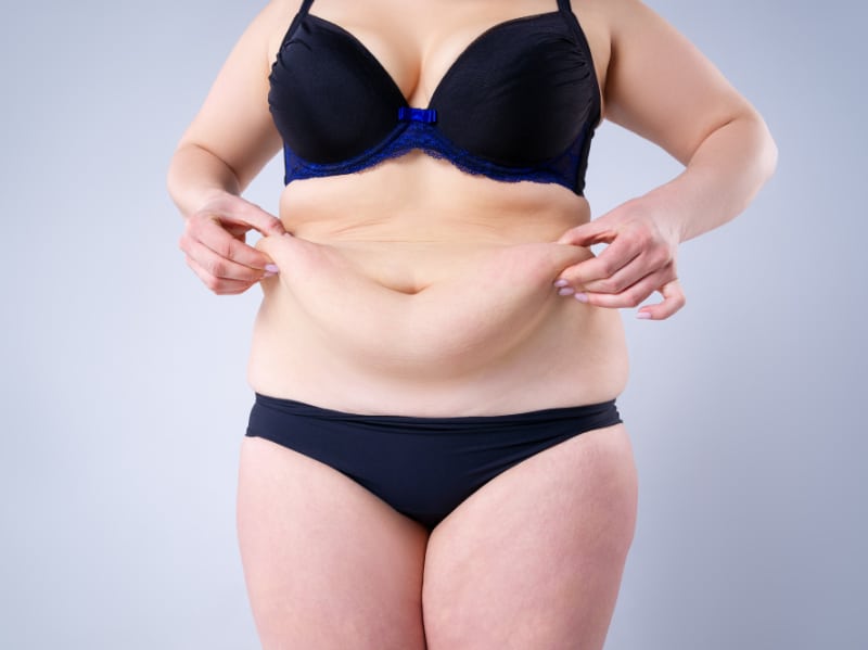 5 Things I Wish I Knew Before Tummy Tuck