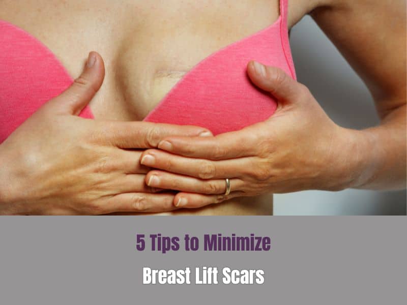 5 Tips to Minimize Breast Lift Scars