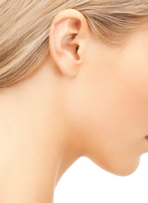 Adult Otoplasty