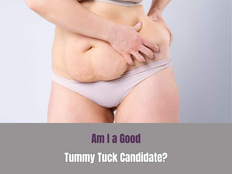 Am I a Good Tummy Tuck Candidate?
