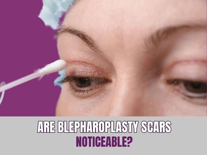 Are Blepharoplasty Scars Noticeable?