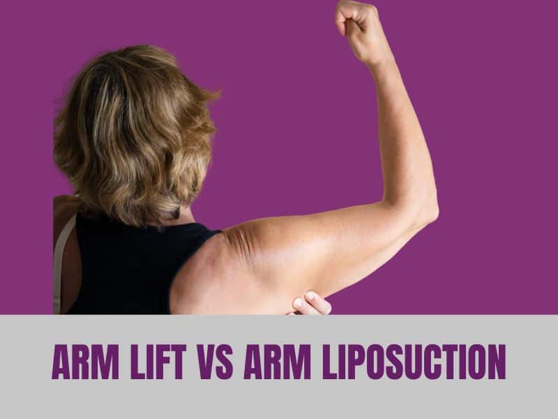 Arm Lift vs Arm Liposuction