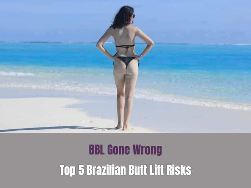 BBL Gone Wrong Top 5 Brazilian Butt Lift Risks