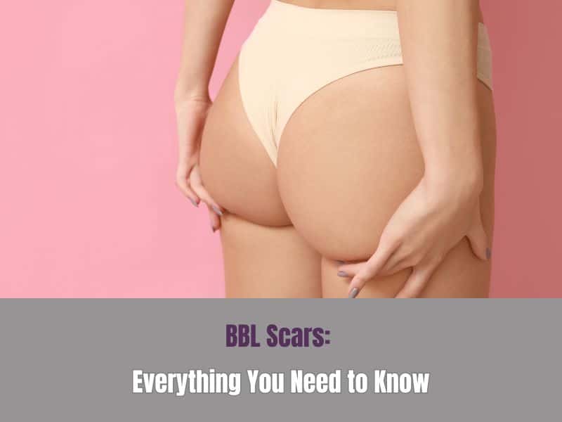 BBL Scars Everything You Need to Know