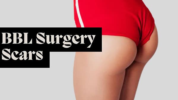 BBL Surgery Scars