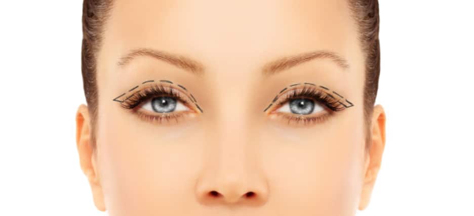 Blepharoplasty Cost