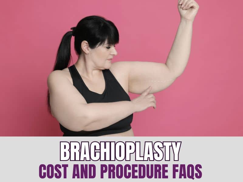 Brachioplasty Cost and Procedure FAQs