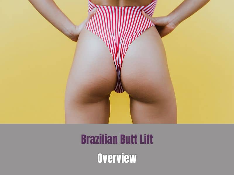 Brazilian Butt Lift Overview