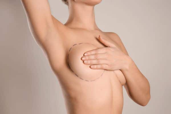 Breast Augmentation Fat Transfer Recovery