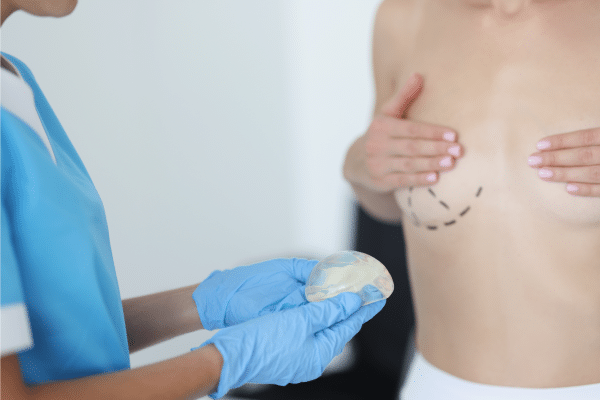 Breast Augmentation Scars