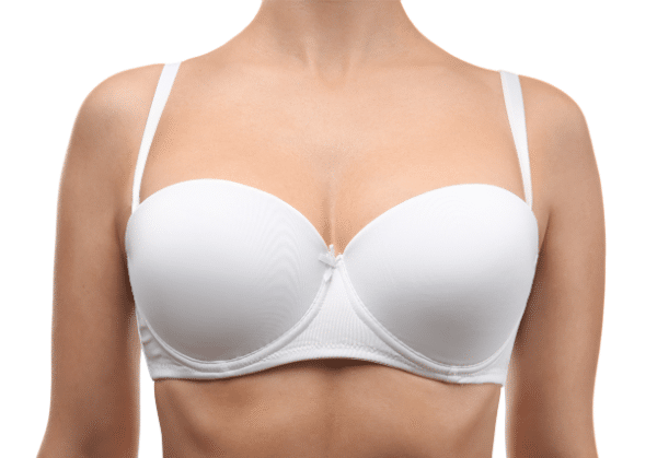 Breast Augmentation With Fat Transfer Scars
