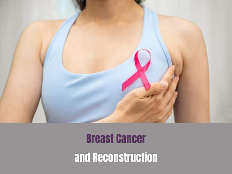 Breast Cancer and Reconstruction