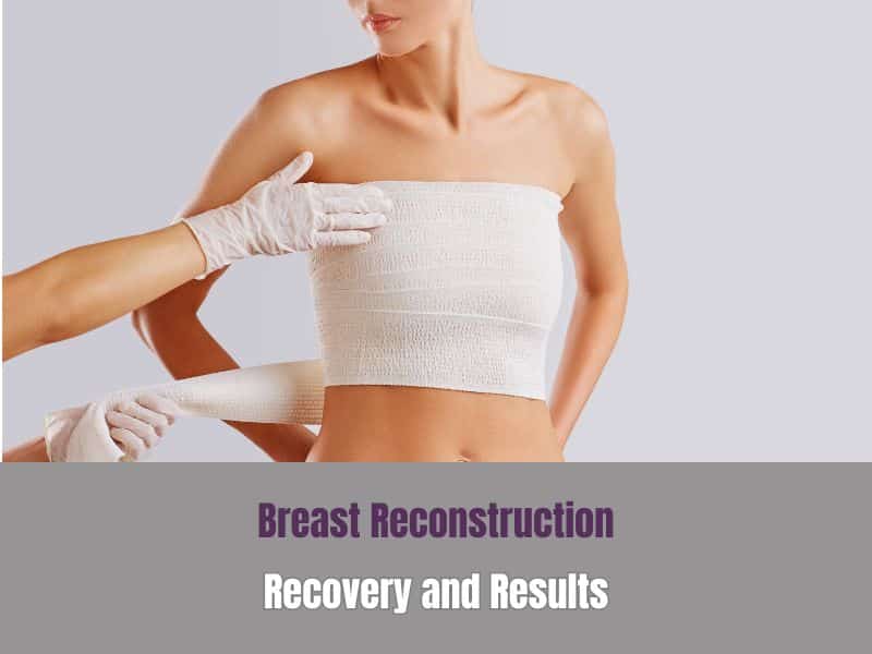 Breast Reconstruction Recover and Results