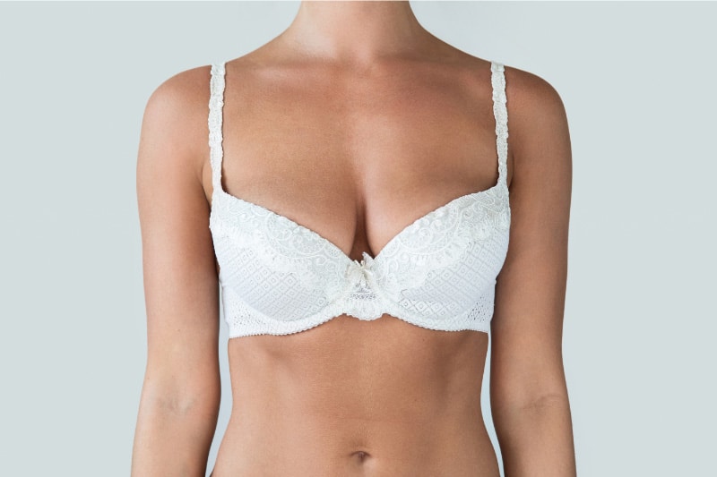 Breast reduction surgery scars