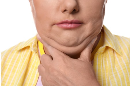 Chin lipo recovery time