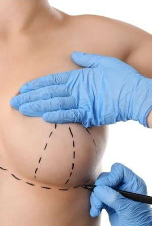 Different Types of Breast Lift Incisions