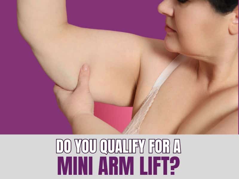 Do You Qualify for a Mini Arm Lift