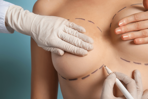 Does Health Insurance Cover Breast Implant Removal