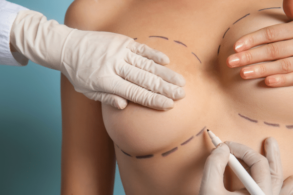 3 Things to Notice in Breast Explant Before and After Photos