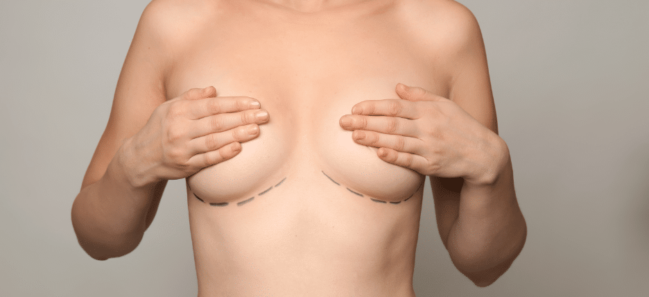 Does Insurance Cover Breast Implant Removal?