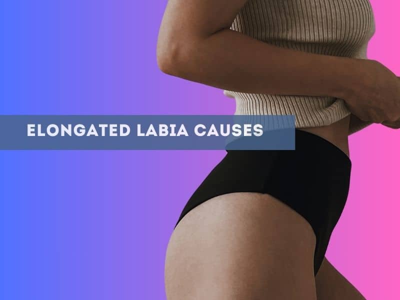 Elongated Labia Causes