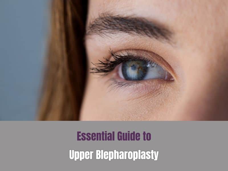 Essential Guide to Upper Blepharoplasty