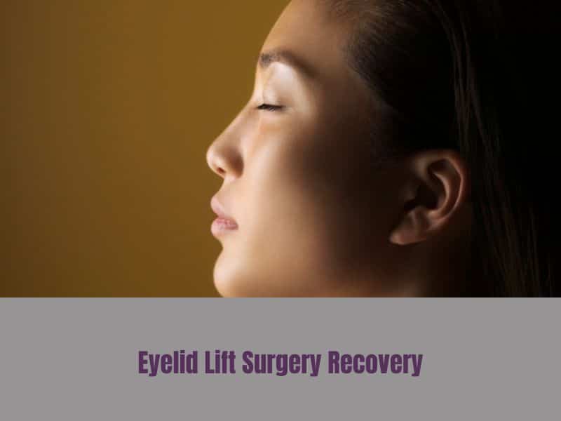 Eyelid Lift Surgery Recovery