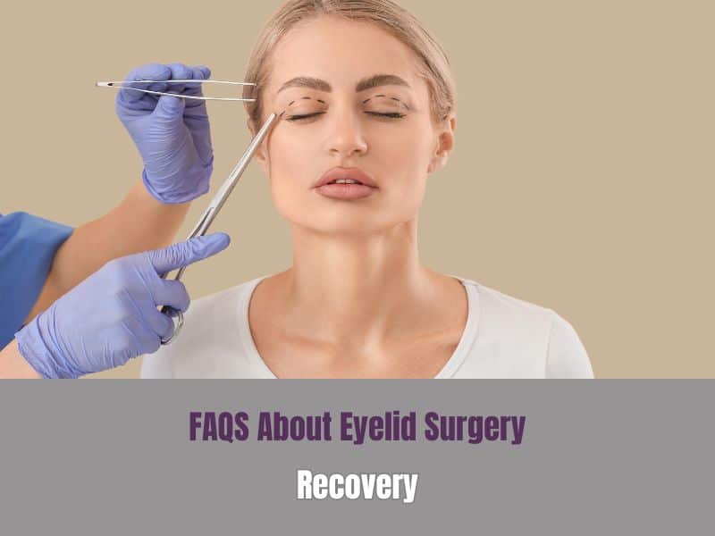 FAQS About Eyelid Surgery Recovery