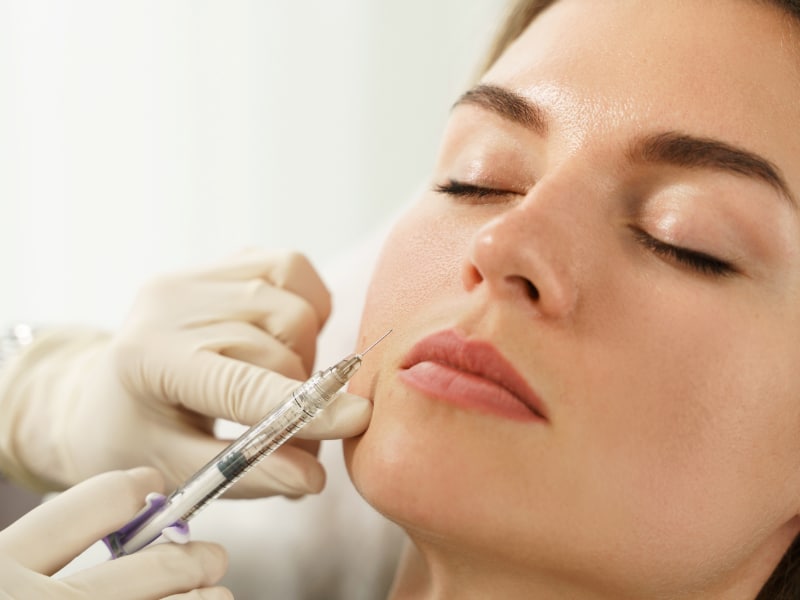 Facial Balancing With Fillers