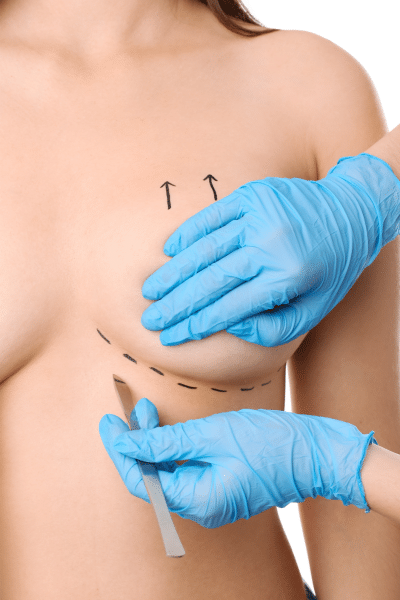 Fat Transfer Breast Augmentation Scars