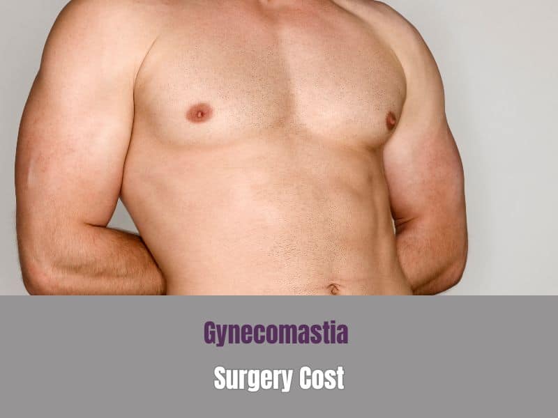 Gyno Surgery Cost