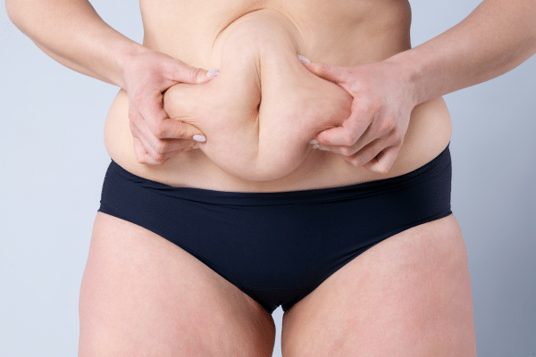 How Much Does A Tummy Tuck Cost