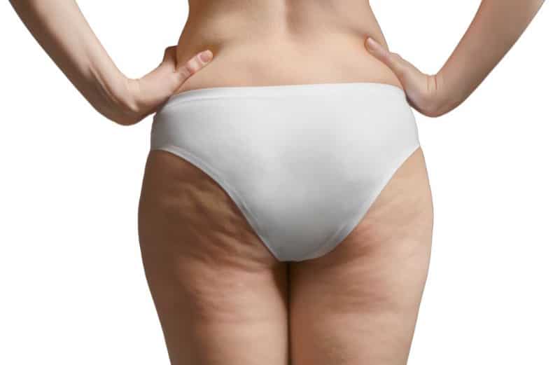 How Much Fat Do You Need for BBL