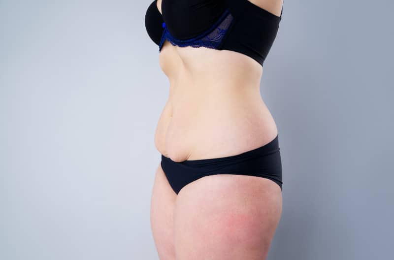 How to maximize liposuction results