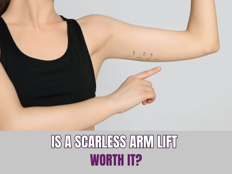 Is a Scarless Arm Lift Worth It