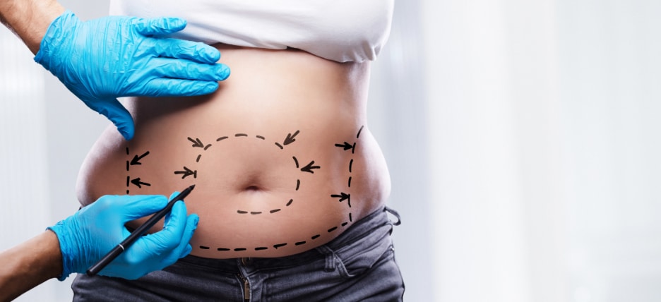 Liposuction Recovery