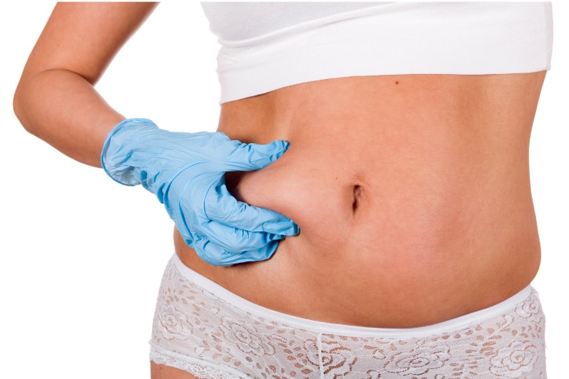 Liposuction results week by week