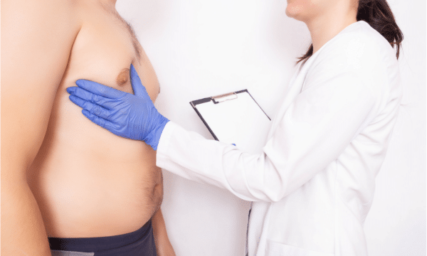 Male Breast Reduction