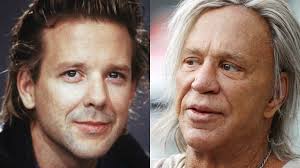 Mickey Rourke plastic surgery