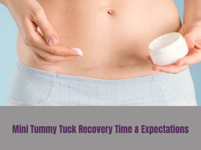 Mini Tummy Tuck Recovery Time & Expectations