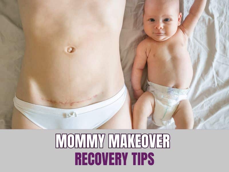 Mommy Makeover Recovery Tips