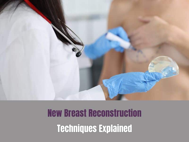 New Breast Reconstruction Techniques