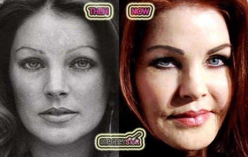 Priscilla presley's botched face job