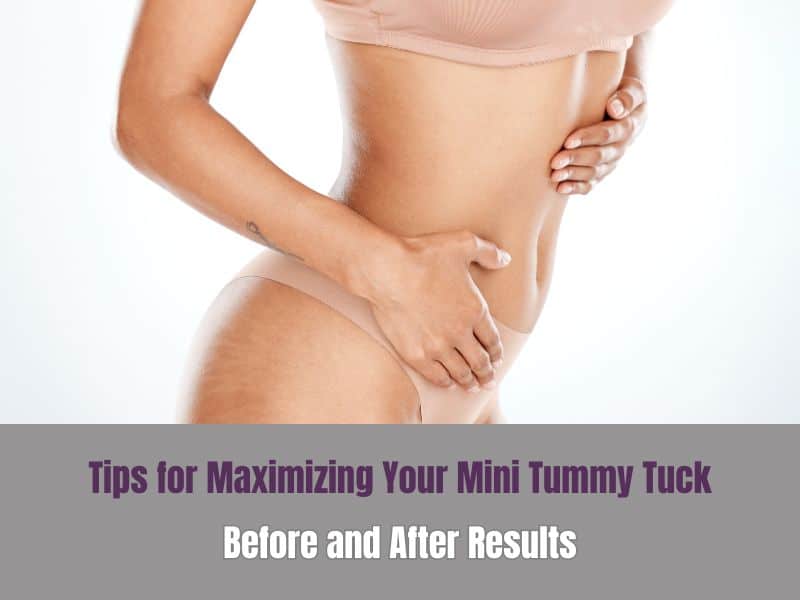 Tips for Maximizing Your Mini Tummy Tuck Before and After Results