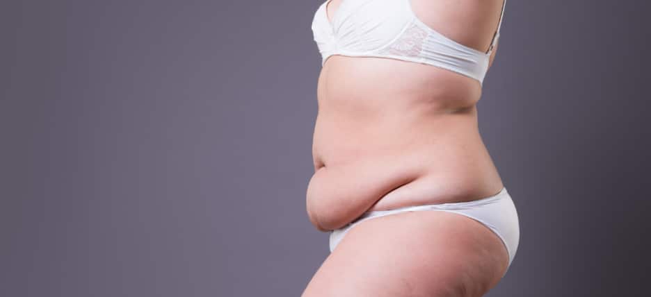 Tummy Tuck Cost