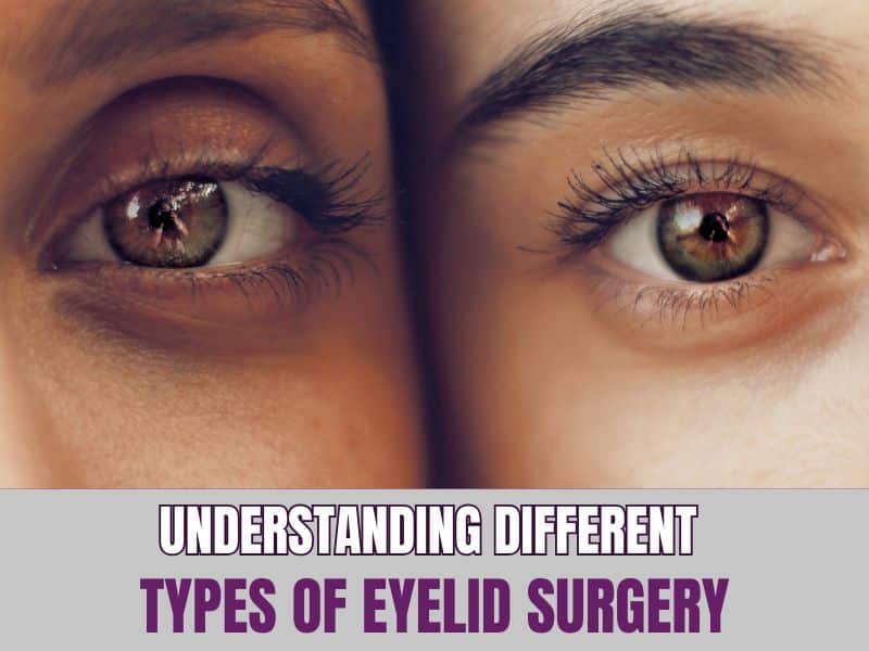 Understanding Different Types of Eyelid Surgery