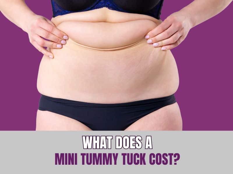 What Does a Mini Tummy Tuck Cost