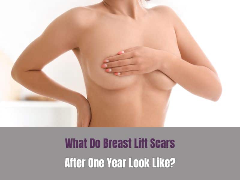 What do breast lift scars after one year look like
