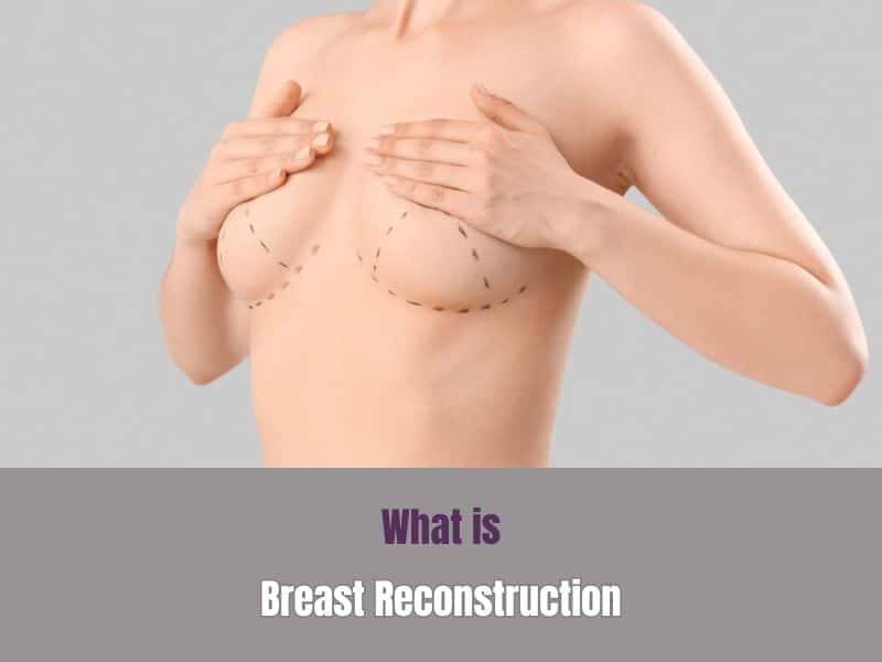 What Is Breast Reconstruction